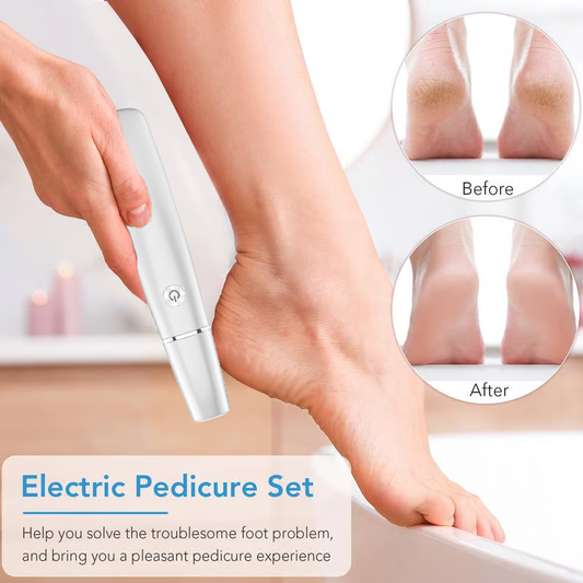 🔥Mother's Day Hot Sale 50%🔥⚡Electric Feet Callus Remover