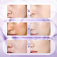 ⚡Hot Sale 50% OFF 🔥🎉All-in-One Niacinamide Cream