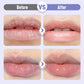 ‌limited-time🛍️Buy 1  get 1 free🎉Plumping & Anti-Wrinkle Hydrating Lip Serum
